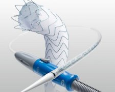 Medtronic Valiant thoracic aortic stent graft | Used in Aortic stenting, Endovascular aneurysm repair (EVAR), Thoracic Endovascular Aneurysm Repair (TEVAR)  | Which Medical Device
